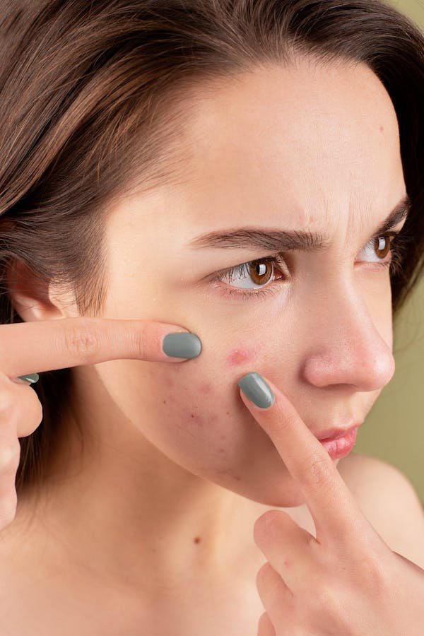 Boutons au visage : astuces naturelles pour les réduire efficacement